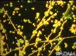 Candida, coloración fluorescente