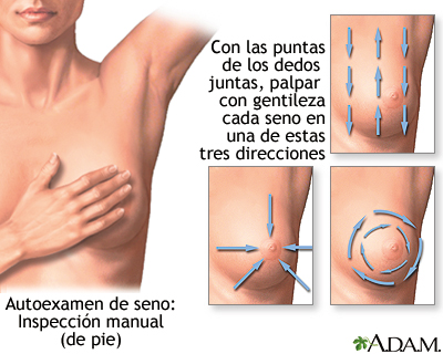 Breast self-exam