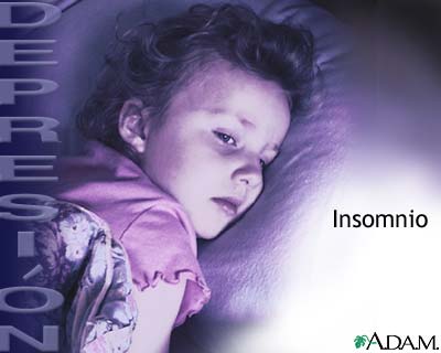 Depresión e insomnio