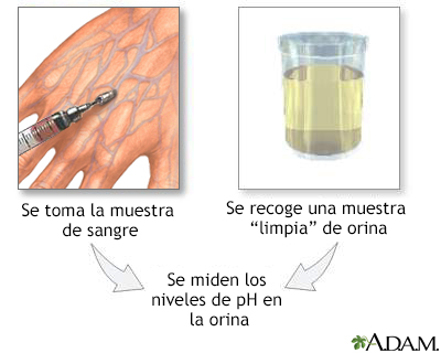 PH urine test