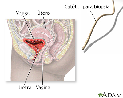Biopsia ureteral